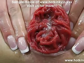 撕开肛门孔